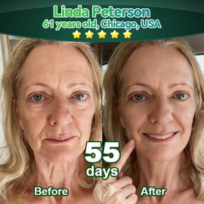 🖤Zvoevo® 𝑆𝑡𝑒𝑚 𝐶𝑒𝑙𝑙 & 𝐶𝑜𝑙𝑙𝑎𝑔𝑒𝑛 𝑃𝑒𝑝𝑡𝑖𝑑𝑒 𝑂𝑟𝑎𝑙 𝐷𝑟𝑜𝑝𝑠 🌱(Lift & Firm Sagging Skin & Reduce Wrinkle Formation)💧 (upsell)