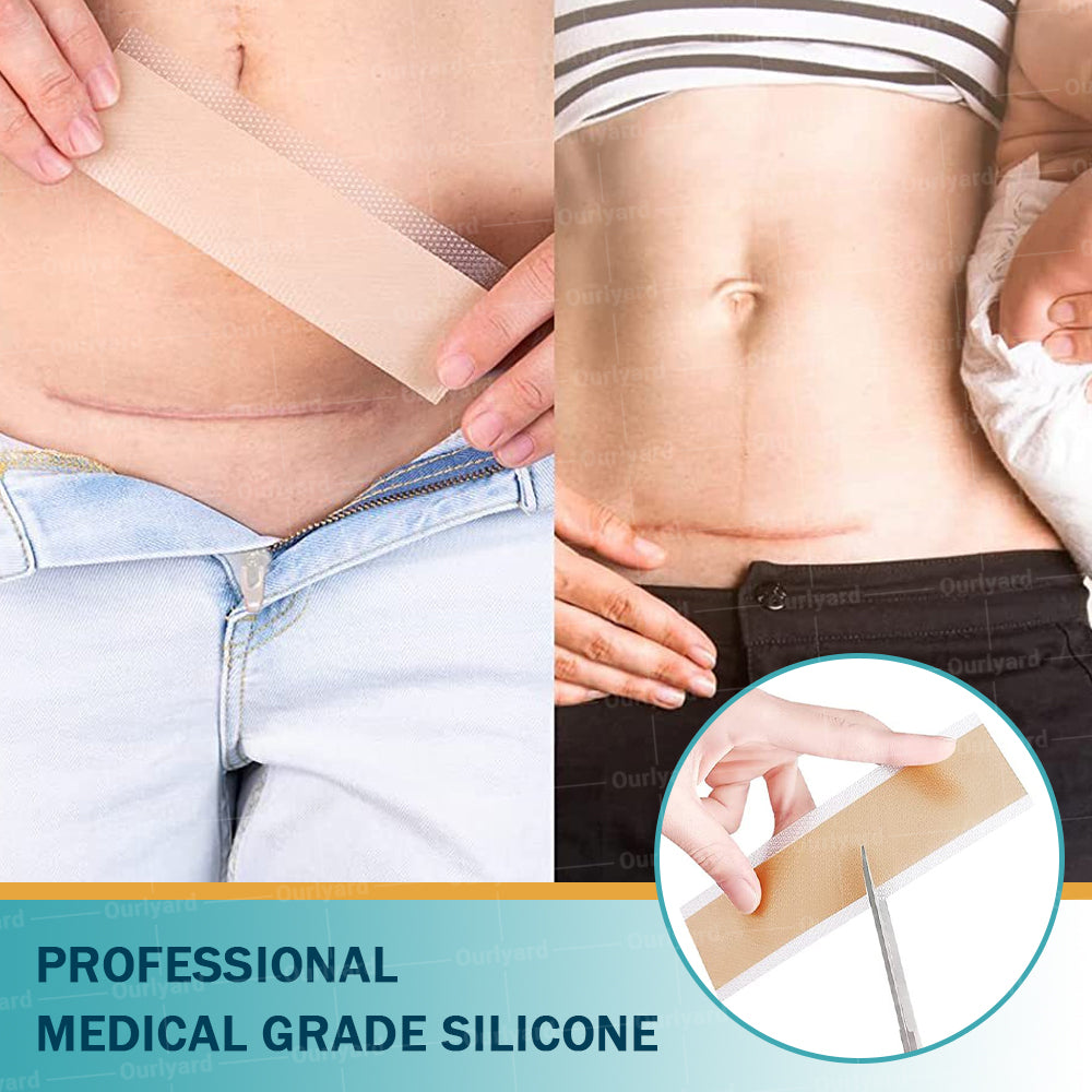 🍉Official Store |Ourlyard® Hyaluronic Acid Nano Microneedle Repair Tape🗽🎉(Treatment of old and new scars, reduction of surgical scars, stretch marks, keloids, acne, burns, warts, dermatomes and varicose veins)