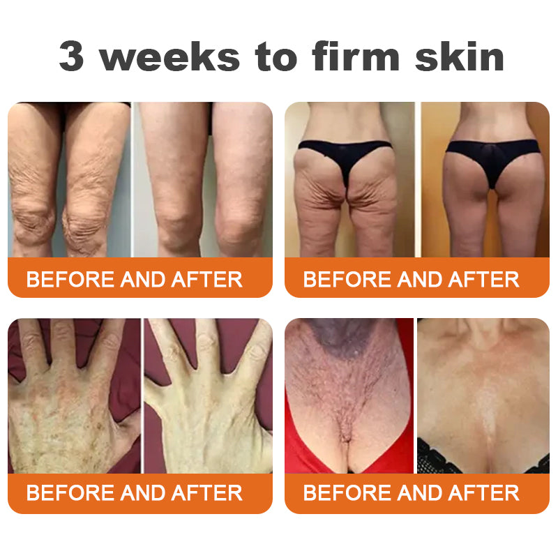 ❤︎Flysmus™ Botox Bee Venom Firming Serum Stick LAST DAY 70% OFF (upsell)