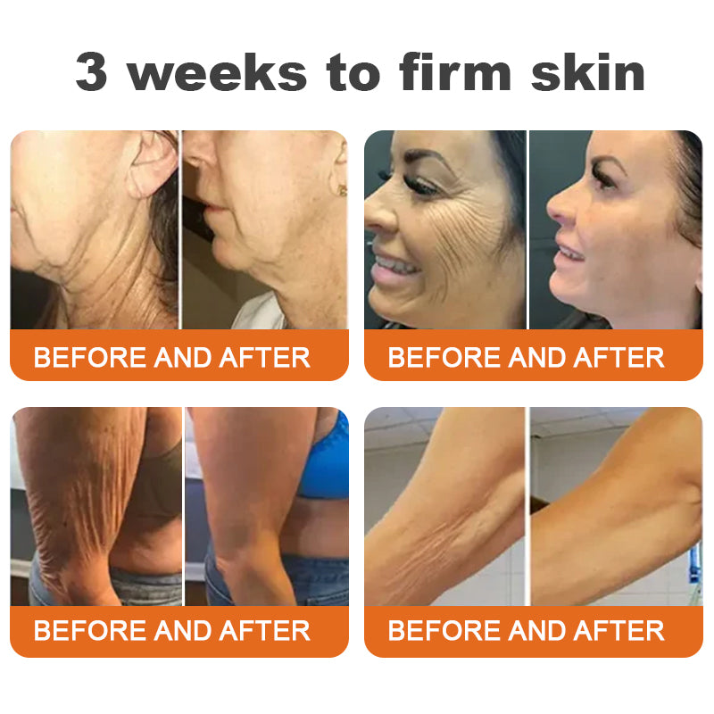 ❤︎Flysmus™ Botox Bee Venom Firming Serum Stick LAST DAY 70% OFF (upsell)