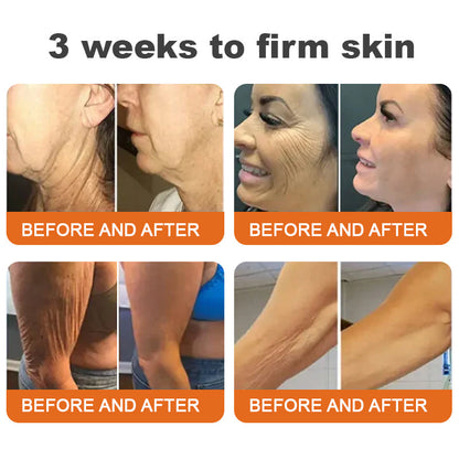 ❤︎Flysmus™ Botox Bee Venom Firming Serum Stick LAST DAY 70% OFF (upsell)