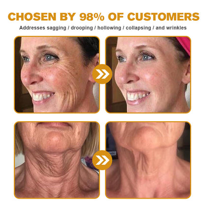 🍈Furzero™ Botox Bee Venom Wrinkle Removal Cream-Last Day Promotion 70% OFF