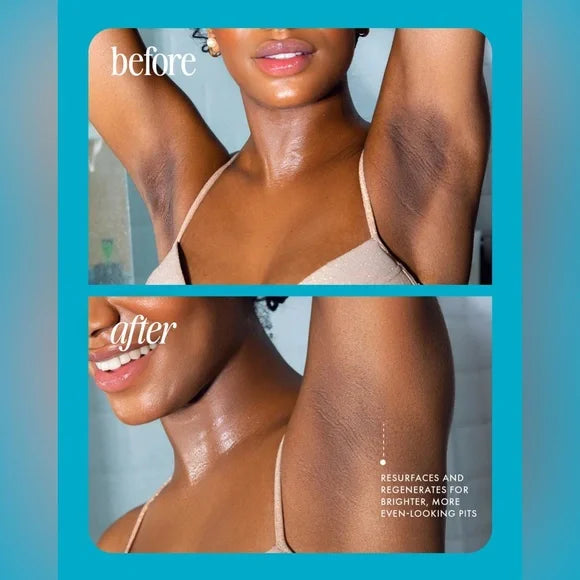 🍇5-Second Post-Hair Removal Rescue: Bumps Fade, Skin Glows! Glass Smooth Oil.